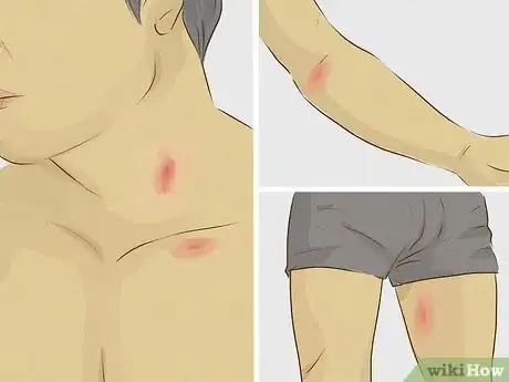 Image titled Give Someone a Hickey Step 5