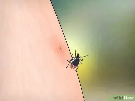 Image titled Remove a Deer Tick Step 16