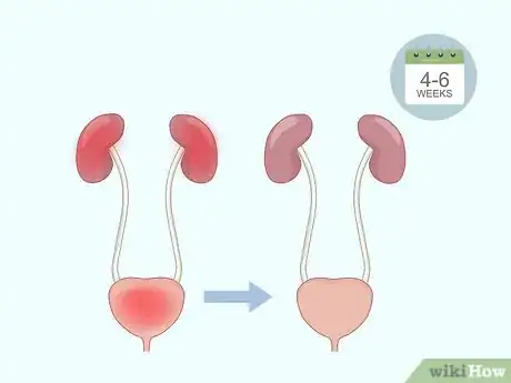 Image titled Do Kegel Exercises Step 14