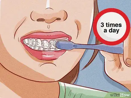 Image titled Brush Your Teeth with a Tongue Piercing Step 5