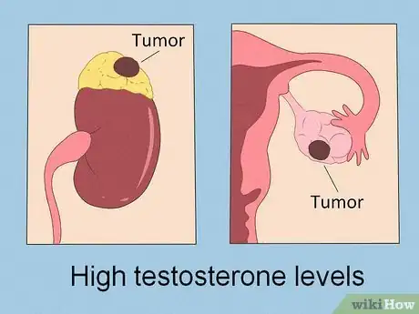 Image titled Lower Testosterone Levels Step 8