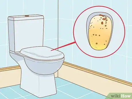 Image titled Diagnose Exocrine Pancreatic Insufficiency Step 3