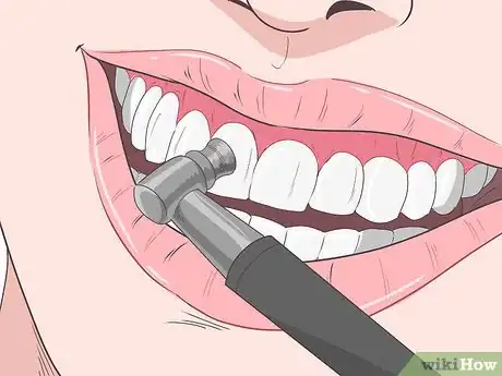 Image titled Remove Brown Stains from Teeth Step 6