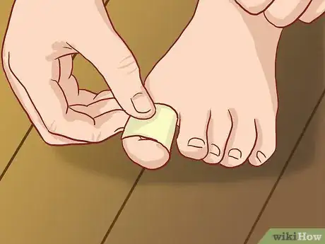 Image titled Straighten Toes Step 8