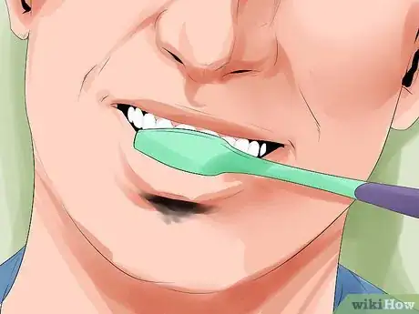 Image titled Avoid Dental Crown Problems Step 12