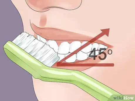 Image titled Stop Gum Recession Step 3