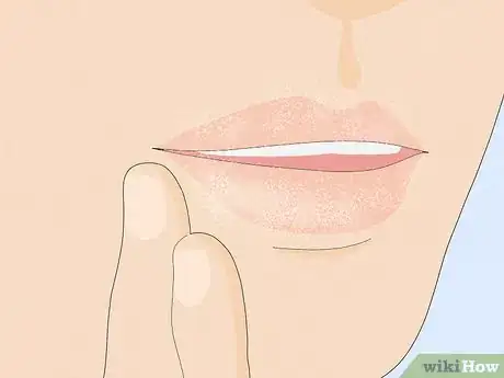 Image titled Treat and Prevent Dry or Cracked Lips Step 5