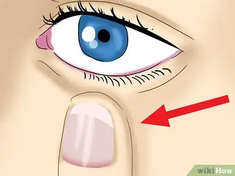 Image titled Take Out Contact Lenses Without Touching Your Eye Step 7