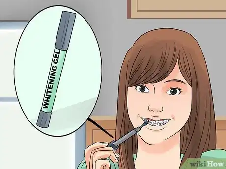 Image titled Whiten Your Teeth when You Have Braces Step 6