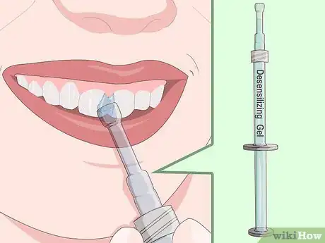 Image titled Protect Gums During Teeth Whitening Step 6