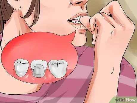 Image titled Avoid Dental Crown Problems Step 13