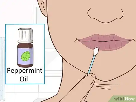 Image titled Prevent a Cold Sore from Forming Step 16