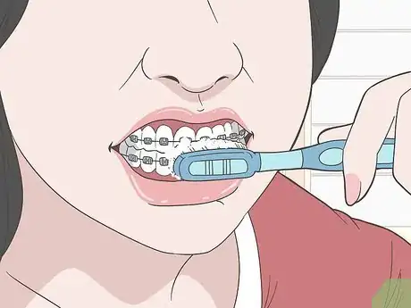 Image titled Eat Food With New or Tightened Braces Step 11