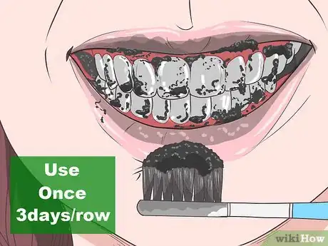 Image titled Remove Tea Stains from Teeth Step 3