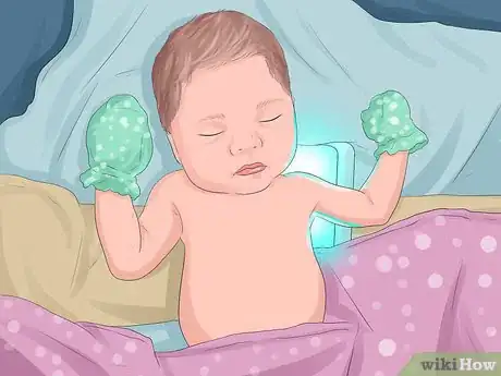 Image titled Prevent Jaundice in Newborns Step 6