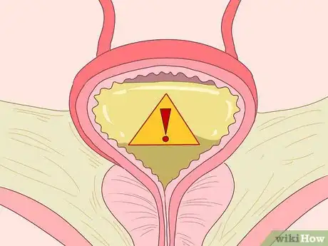 Image titled Reduce Protein in Urine Step 4