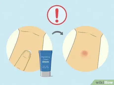 Image titled Remove Male Pubic Hair Without Shaving Step 7