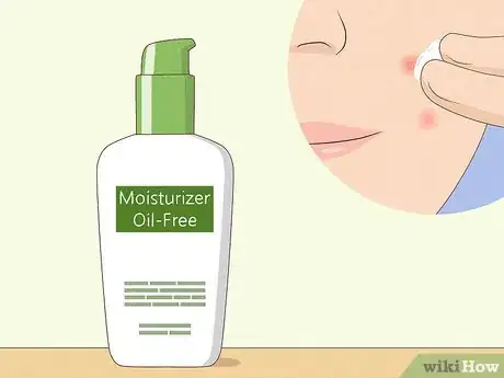 Image titled Reduce the Swelling and Redness of Pimples Step 11