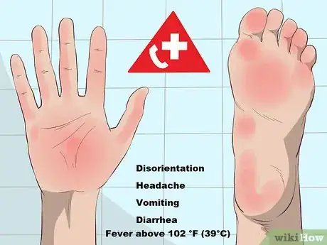 Image titled Recognize Staph Infection Symptoms Step 9