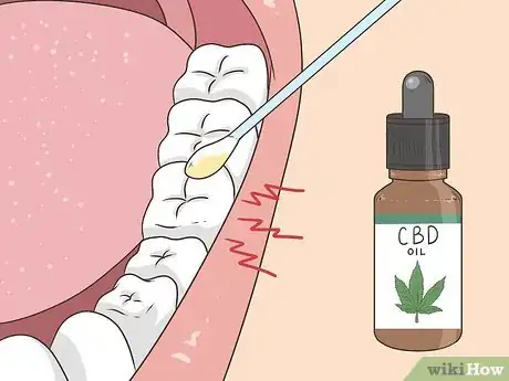 Image titled Use CBD Oil for Tooth Pain Step 1