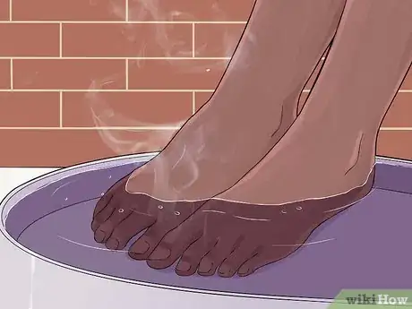 Image titled Get Rid of Plantar Warts (Verrucas) Step 2