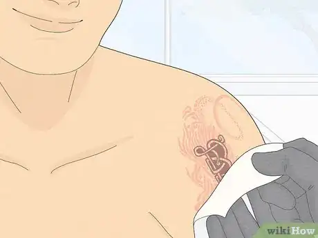 Image titled Fix a Bad Tattoo Step 3