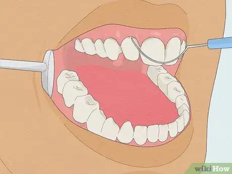 Image titled Fix Rotting Teeth Step 11