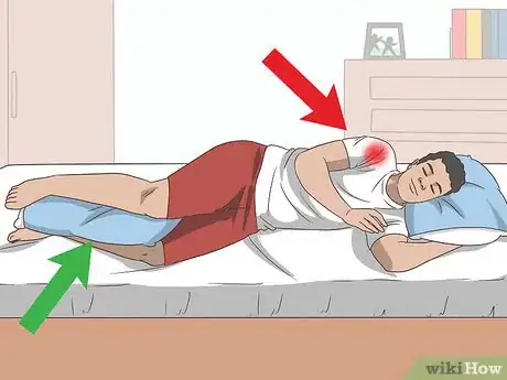 Image titled Sleep with Rotator Cuff Pain Step 2