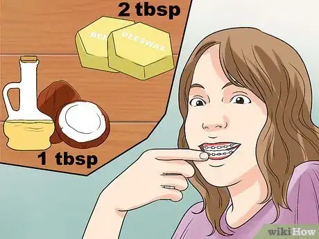 Image titled Treat Canker Sores (Home Remedies) Step 15