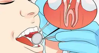 Stop Root Canal Pain