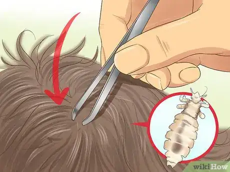 Image titled Check a Child's Hair for Lice Step 13