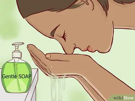 Image titled Treat Eczema Around the Eyes Step 15