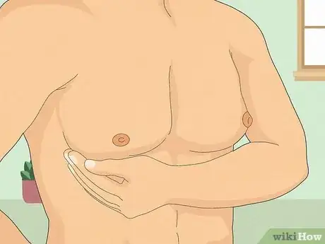 Image titled Detect Gynecomastia Step 1