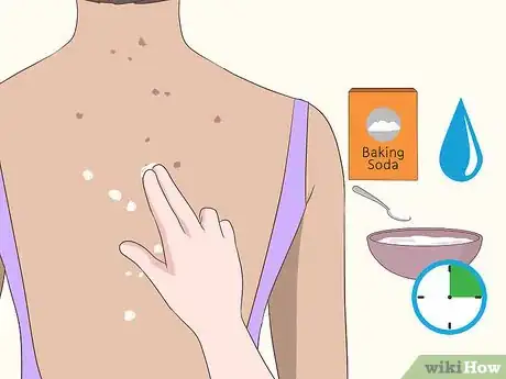 Image titled Get Rid of Back Acne Scars Step 6