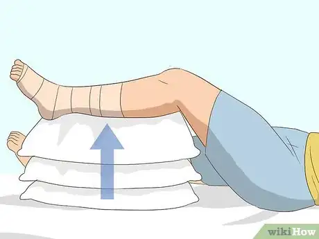 Image titled Wrap an Ankle with an ACE Bandage Step 14