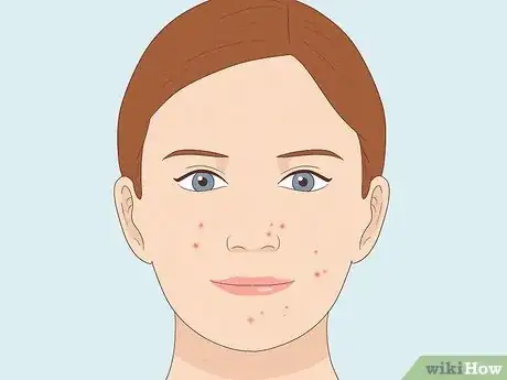 Image titled Best Skincare Products Step 5