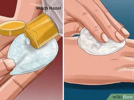 Image titled Apply Witch Hazel to Your Face Step 11