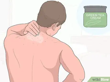 Image titled Naturally Get Rid of Back Acne Step 14