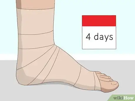 Image titled Wrap an Ankle with an ACE Bandage Step 11