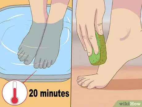 Image titled Remove Dead Skin from Feet Step 4