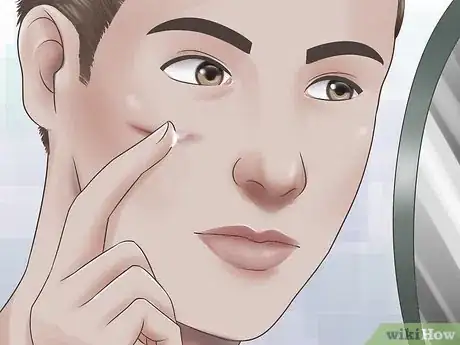 Image titled Get Rid of a Cut on Your Face Step 5