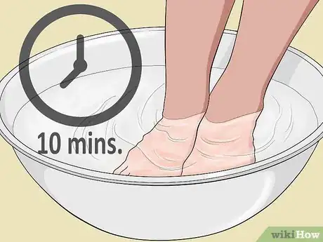 Image titled Tell if an Ingrown Toenail Is Infected Step 5