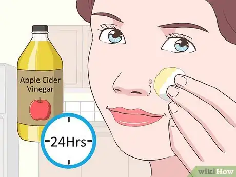 Image titled Remove Facial Warts Step 1