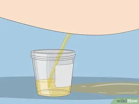 Image titled Help a Female Child Provide a Urine Sample Step 6