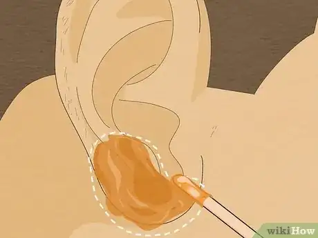 Image titled Wax Ear Hairs Step 7