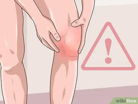 Image titled Diagnose Septic Arthritis Step 2