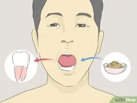 Image titled Eat After a Tooth Extraction Step 5