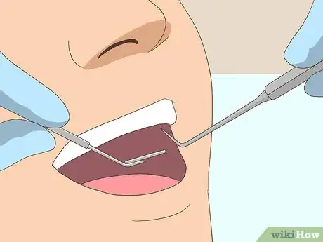 Image titled Treat Bad Breath Step 13