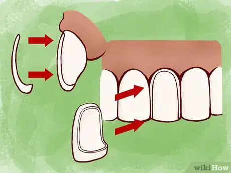 Image titled Strengthen Tooth Enamel Step 7