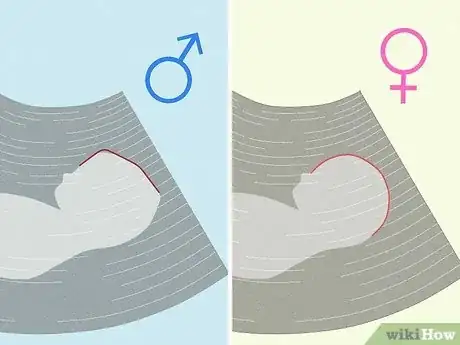 Image titled Tell if You're Pregnant with a Girl or Boy Step 1